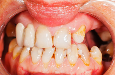 Before image